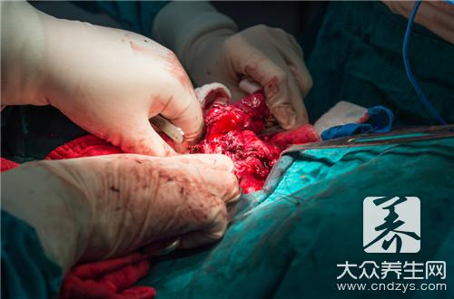 甲状腺癌能治愈吗